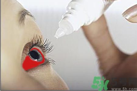 紅眼病的表現狀態有哪些?紅眼病怎么治療? 紅眼病的表現狀態有哪些?紅眼病怎么治療?