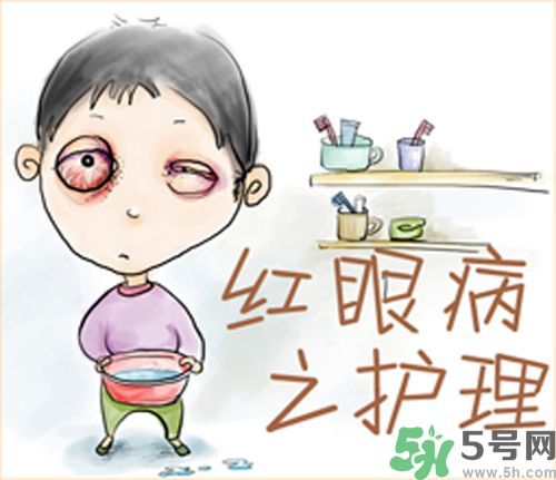 紅眼病的表現狀態有哪些?紅眼病怎么治療? 紅眼病的表現狀態有哪些?紅眼病怎么治療?