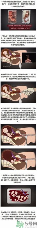墮胎手術的可怕細節