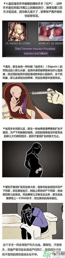 墮胎手術的可怕細節