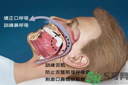 耳鳴是什么原因引起的？耳鳴怎么治療最好？