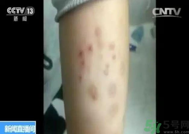 被污染學校是哪個？500師生患病的原因？