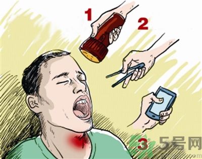 魚刺卡喉喝醋可以治療嗎？魚刺卡喉喝醋好不好？