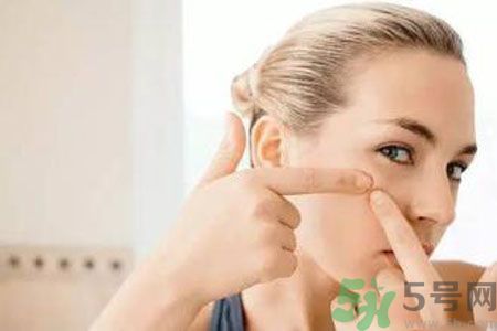 一到夏天呢長(zhǎng)痘痘怎么回事？夏天長(zhǎng)痘痘怎么辦？