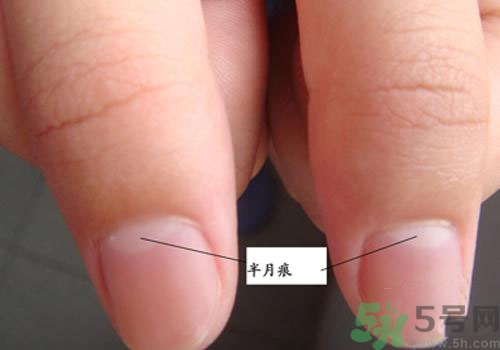 指甲沒有月牙是什么原因？指甲沒有月牙怎么調理？