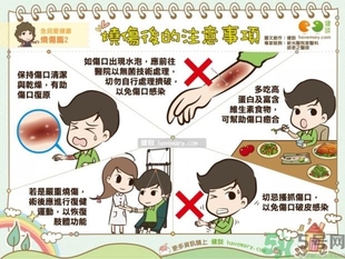 手被油燙傷了怎么處理？手被油燙起泡了怎么辦？