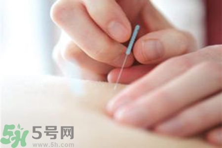大暑可以針灸嗎？大暑針灸好不好？