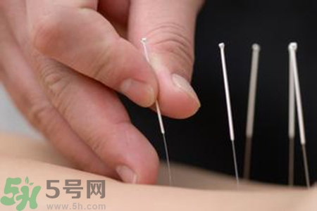 大暑可以針灸嗎?大暑針灸好不好? 大暑可以針灸嗎?大暑針灸好不好?