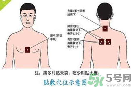肝炎貼三伏貼有用嗎？肝病貼三伏貼貼哪里？