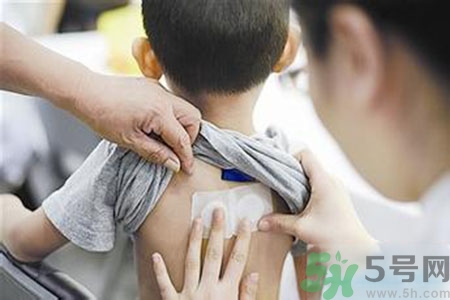 三伏貼能治頸椎病嗎？頸椎病三伏貼穴位