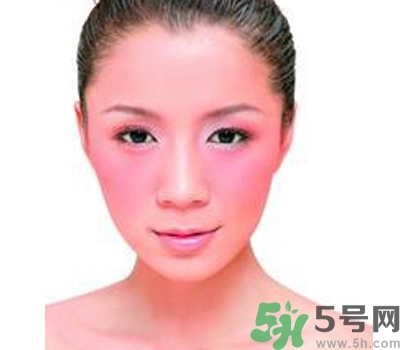 敏感性皮膚用什么洗面奶？敏感性皮膚怎么修復？