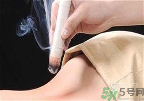 蕁麻疹可以艾灸嗎？蕁麻疹艾灸哪個穴位？