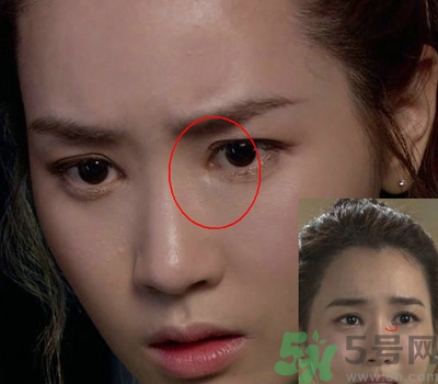 開眼角多少錢？開眼角有什么危害？