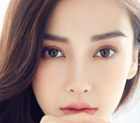 開眼角會留疤嗎？開眼角增生怎么辦？