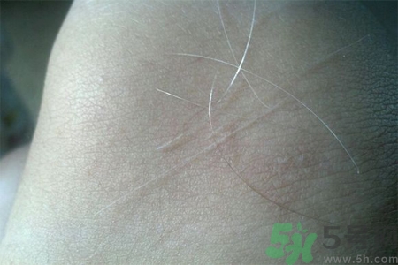 生完寶寶白頭發的原因？生完寶寶白頭發怎么辦？