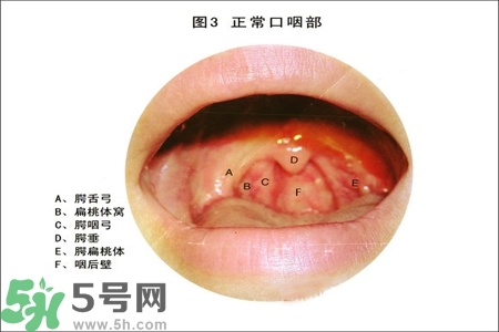慢性咽炎的治療方法？慢性咽炎的藥物治療？