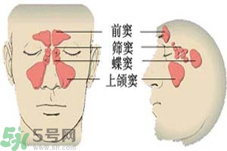 鼻竇炎是什么？鼻竇炎的癥狀有哪些？
