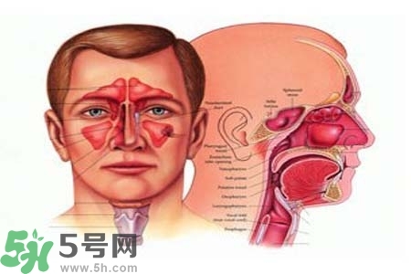 鼻竇炎的高發人群？如何預防鼻竇炎？