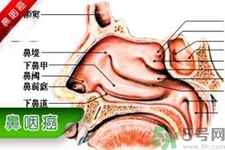 鼻咽癌的發(fā)病因素是什么？鼻咽癌的并發(fā)癥有哪些？