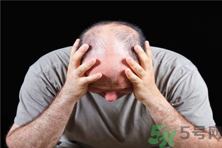 脫發(fā)的治療方法是什么？脫發(fā)的藥物治療有哪些？