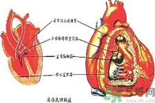 先天性心臟病可以用藥物治療嗎？