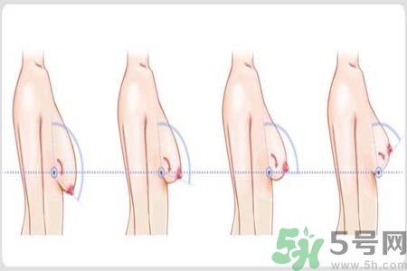 胸部松弛的原因是什么？胸部松弛該怎么辦？