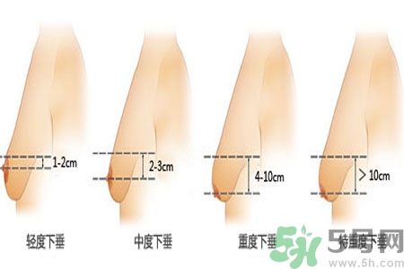 胸部松弛的原因是什么？胸部松弛該怎么辦？