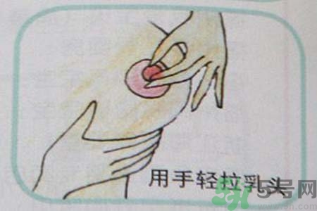 乳頭內陷怎么回事？乳頭內陷的原因是什么？