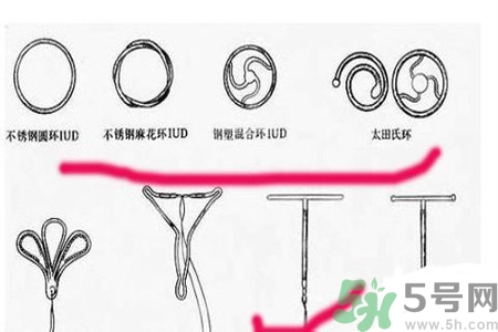 避孕的辦法有什么？避孕的方法有哪些？