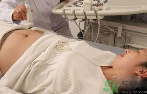 孕婦做b超要空腹嗎？孕婦做b超要不要空腹？