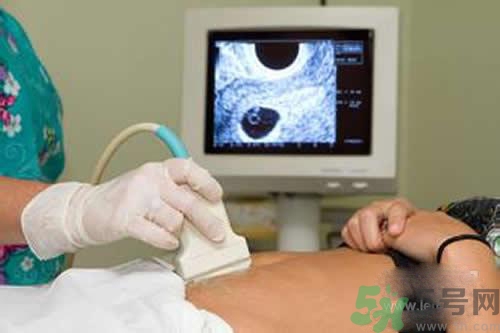 孕婦做b超要空腹嗎？孕婦做b超要不要空腹？