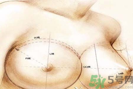 乳頭內(nèi)陷可以用吸奶器嗎？乳頭內(nèi)陷能不能用吸奶器？