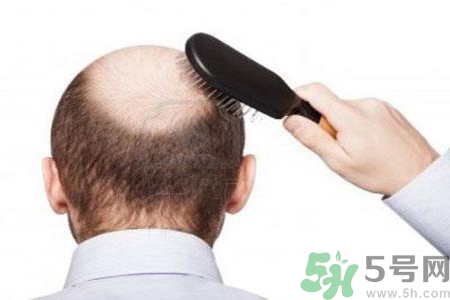 男性更年期的表現(xiàn)有哪些？怎么判斷男性更年期？