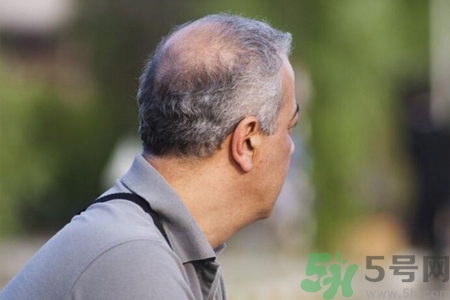 男性更年期的表現(xiàn)有哪些？怎么判斷男性更年期？