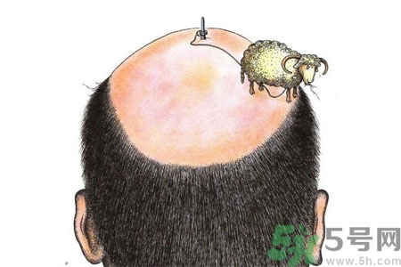 頭發稀少的原因是什么？如何預防禿頂的發生？