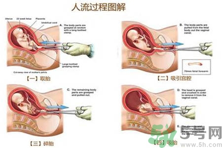 人流后怎么調養(yǎng)身體？人流后飲食需注意什么？