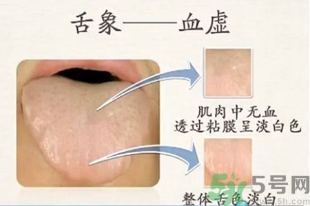 血虛的癥狀是什么？血虛的表現(xiàn)有哪些？