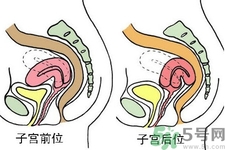 ?子宮移位怎么治療？子宮移位能懷孕嗎？