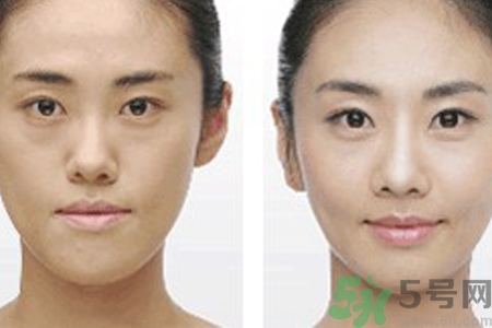 激光縮毛孔多少錢(qián)一次？激光縮毛孔一個(gè)療程多少錢(qián)？