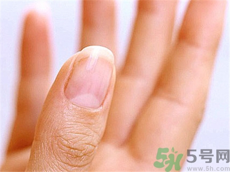 手指月牙怎么補回來?手指月牙少怎么調理?