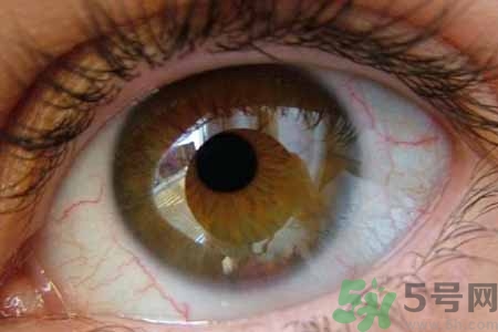 ?干眼癥的治療方法是什么？如何預防干眼癥？