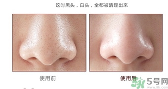 yu.r巧克力棒鼻貼怎么樣？yu.r巧克力鼻貼好用嗎？