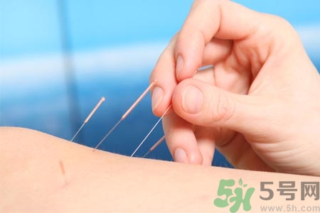 針灸一次要扎多長(zhǎng)時(shí)間？針灸可以幾天做一次？