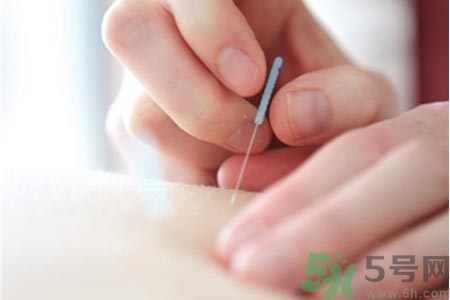 針灸一次要扎多長(zhǎng)時(shí)間？針灸可以幾天做一次？