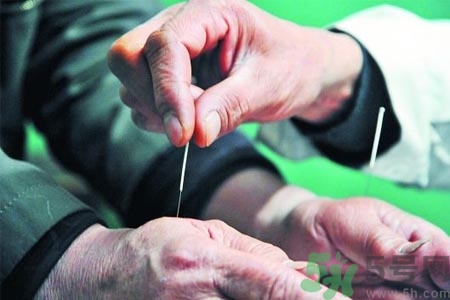 針灸一次要扎多長(zhǎng)時(shí)間？針灸可以幾天做一次？