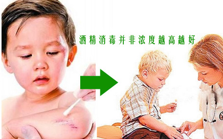 酒精濕巾會腐蝕衣服嗎 長期使用酒精濕巾的危害