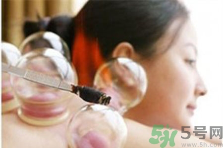 肩膀酸痛可以拔火罐嗎？孕婦肩膀酸痛能拔火罐嗎？