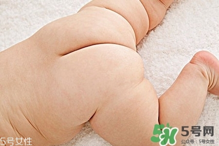 擴(kuò)肛疼嗎？擴(kuò)肛手術(shù)會很疼嗎？