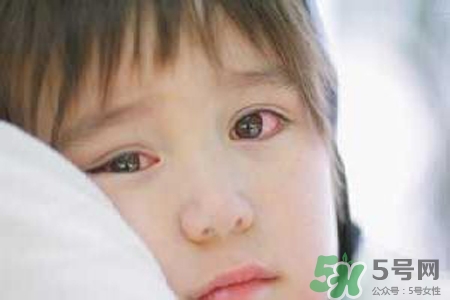 孩子為什么老眨眼睛？孩子總眨眼睛怎么回事？