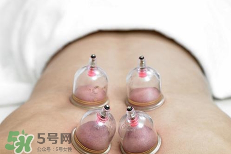 拔罐后可以貼膏藥嗎?拔罐后多久能貼膏藥? 拔罐后可以貼膏藥嗎?拔罐后多久能貼膏藥?